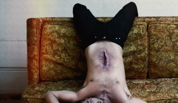 rpatz cronenberg 1