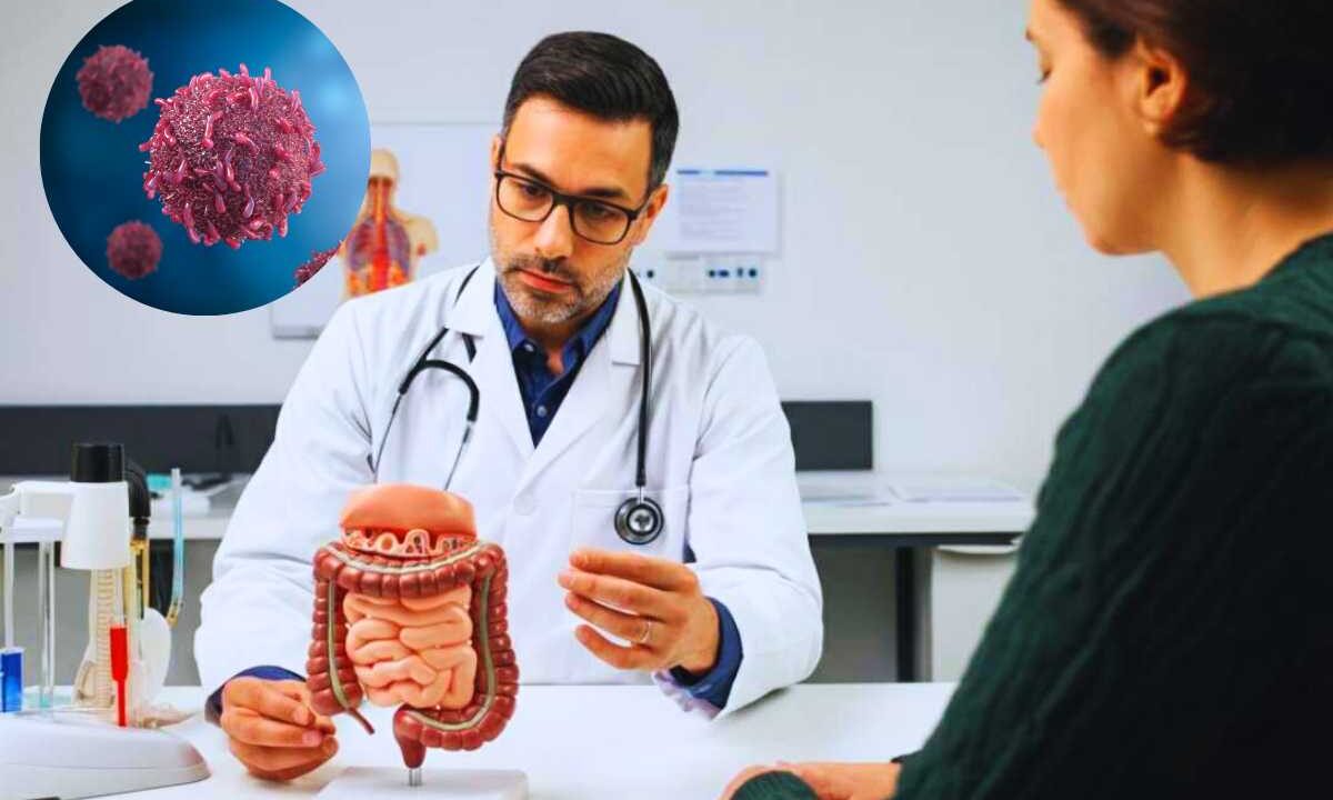 sintomi del cancro al colon