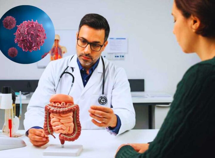 sintomi del cancro al colon